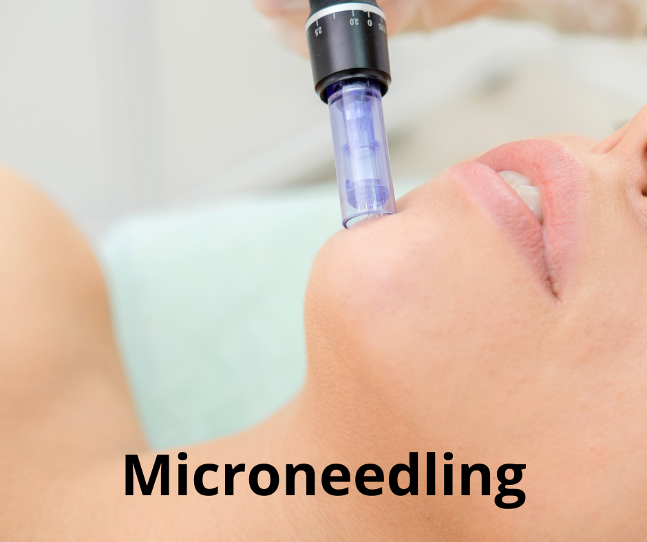 microneedling
